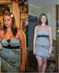 Как похудеть подростку на 10 кг Как похудеть подростку на 10 кг