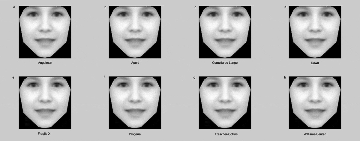 Врачи смогут ставить диагноз по фотографиям пациентов