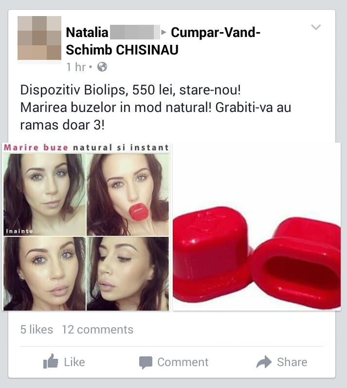 Capacul care mărește buzele în câteva minute, se vinde și la Chișinău. Ce au pățit mii de fete care l-au folosit