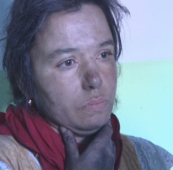 Гражданка Молдовы, чей ребенок получил ожоги в результате пожара, разыскивается в Башкирии