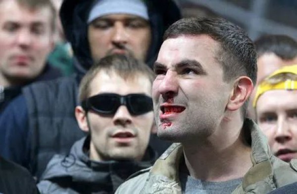 Фанату сборной России, назвавшим украинцев "фашистами", разбили нос за флаг ДНР