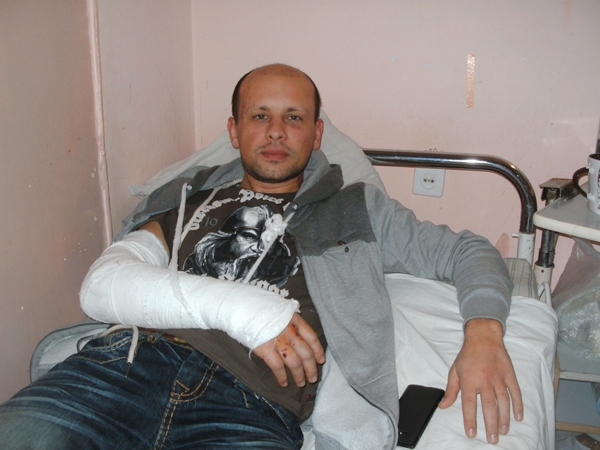 „Беркутовцы“ били нас дубинками по голеням и пяткам, требуя сказать, кто сжег их автобус»