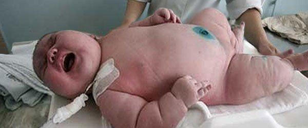 Nou-născut de 16 kilograme. O femeie din SUA a şocat medicii