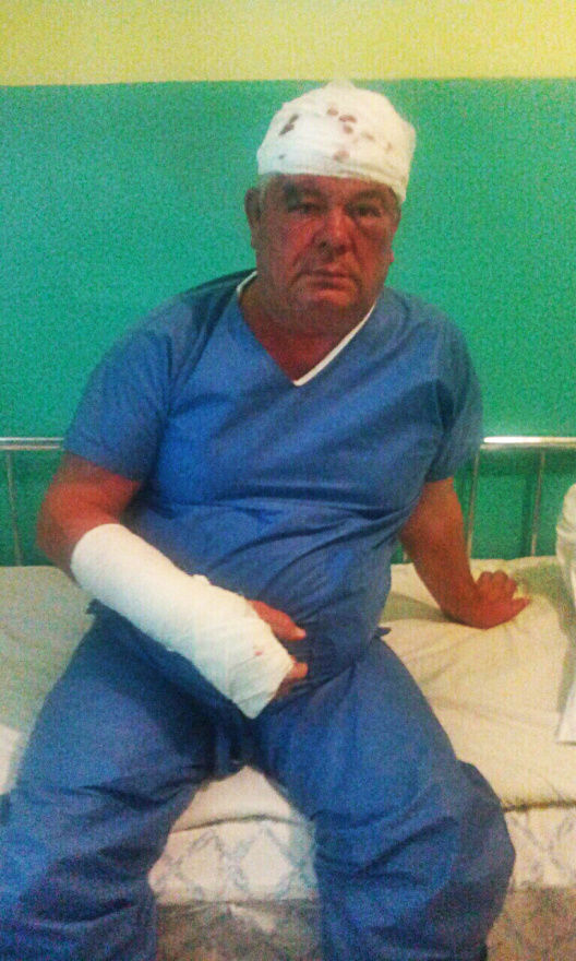 Un candidat pentru funcţia de primar, bătut în propria casă de trei tipi mascaţi