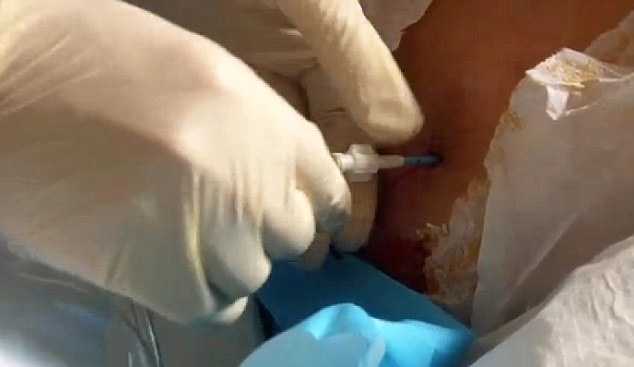 35-летняя британка до конца жизни может остаться беременной