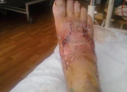 Un bărbat din Râbniţa a fost maltratat de miliţia transnistreană