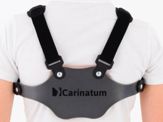 Ортез Carinatum