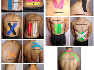 Кинезио тейпы. Kinesio tape. Banda kinesiologica. Korea, China, Italy, Germany. foto 8