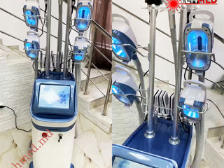 Аппарат для криолиполиза CRYO-360 Aparat de criolipoliză Cryolipolysis apparatus CRYO-360 foto 5