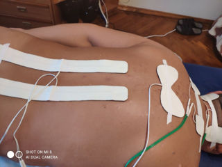 Tractia coloanei,terapie,masaj,electroforeza,amplipuls,atirnare serioasa foto 8