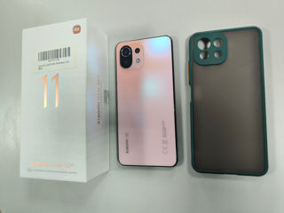 Xiaomi 11 Lite 5G NE