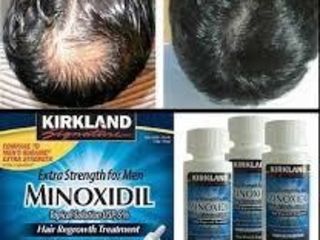 erectie minoxidil