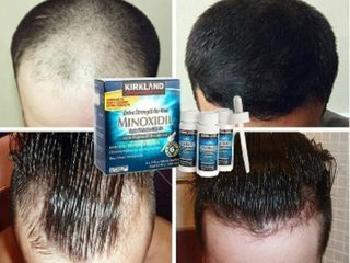 Оригинальный Minoxidil - революционное средство для роста волос и бороды! foto 2