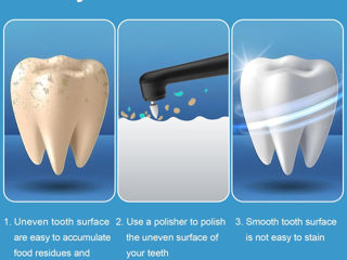Slefuitor de dinți electric  Электрический полировщик зубов foto 6