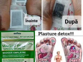 Plasture detox pentru picioare și Plasture ortopedic pentru spate foto 2