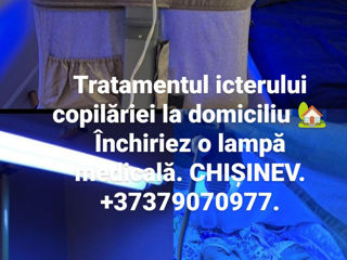 Tratamentul icterului copilăriei acasă! Închiriere lămpi medicale Philips. Ochelari pentru ochi. foto 8