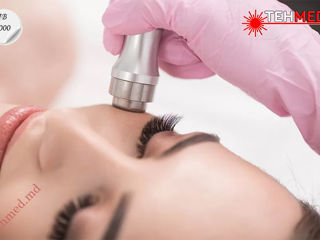 Аппарат микродермабразии IB-7000 Crystal Peeling Dispozitiv de microdermabraziune foto 6