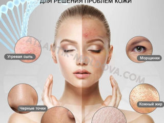 Profesionalul aparat cu ultrasunete pentru curățarea feței.Livrare gratuită în Moldova foto 2