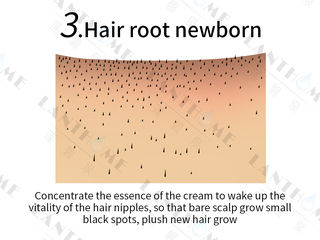 Сыворотка для лечения и стимулирования роста волос. foto 3