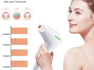 Epilator IPL,Rejuvenare,Curatare acnee, Alb Фотоэпилятор IPL foto 2