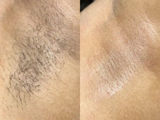 Epilare sugaring/ceara sec. Buiucani foto 5