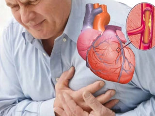 Tratăm toate bolile sistemului cardiovascular Лечим все болезни сердечно-сосудистой системы