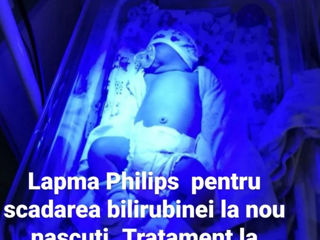 Аренда двойной медицинской лампы Philips для лечения желтухи у малышей дома! Безопасно и эффективно! foto 3