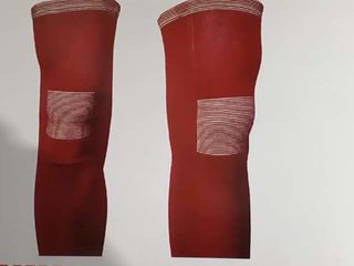 ceai de trandafir cu varicoză pericolele cu varicoză varicoză