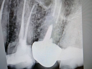 Echipament Radiologie Dentara foto 5