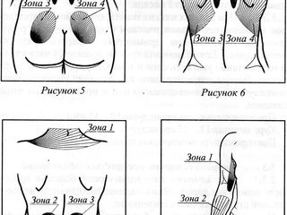 Аппарат низкочастотной магнитотерапии, маг magnetoterapie liumedteh foto 4