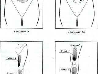 Аппарат низкочастотной магнитотерапии, маг magnetoterapie liumedteh foto 3