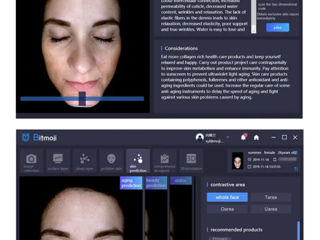 Анализатор 3D кожи лица Skin Analysis System  фото 7