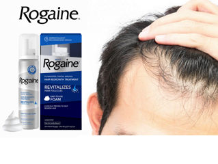 Выпадают волосы? Пена Rogaine c Minoxidil против выпадения волос foto 3