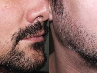 Оригинальный Minoxidil - революционное средство для роста волос и бороды! foto 4