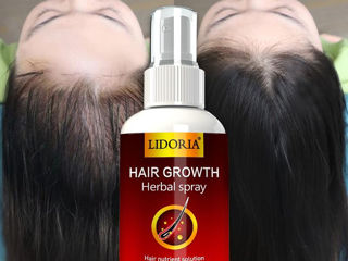 Спрей для роста волос и защиты от выпадения. Hair growth от бренда =Lidoria= foto 3