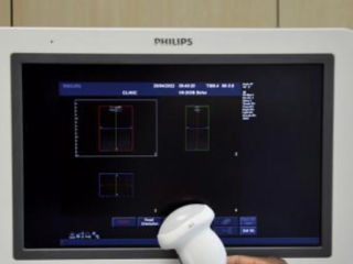 Philips iu22 сканер для ультразвуковых исследований. (узи). . foto 6