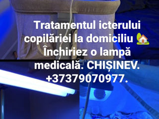 Lampa pentru scăderea bilirubinei. Аренда лампы.! Лечение желтухи у новорожденных на дому! Очки. foto 8