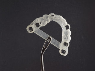  Implant dentar la pret adecvat.  foto 1