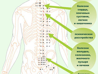 Акупунктурный аппликатор спины foto 3