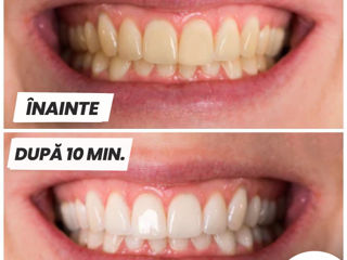 отбеливающие полоски для зубов - MySmile foto 5