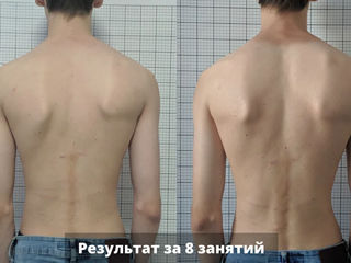 Врач выполняет 2 часа: массаж лечебный,вытяжение,массаж шея воротник,головы,лица,медовый foto 9