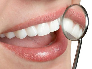 Полоски для отбеливания зубов Crest 3D Whitestrips foto 4