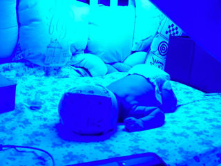 Аренда двойной медицинской лампы Philips для лечения желтухи у малышей дома! Безопасно и эффективно! foto 10