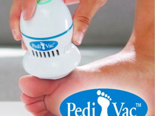 Срочно. Пемза для ног Pedi Vac Прибор для удаления мозолей фото 1
