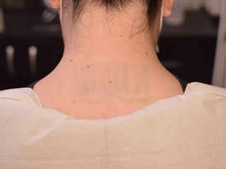 Removal tatt!Eliminarea tatuajelor cu laser Mad-art in Chisinau.Лазерное удаление татуировок Кишинёв foto 6