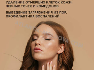 Profesionalul aparat cu ultrasunete pentru curățarea feței.Livrare gratuită în Moldova foto 10