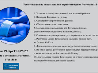 Chiria lămpilor pentru fototerapie - Icter bebelusi / лечение от желтухи ( Livrare in Chisinau) foto 8