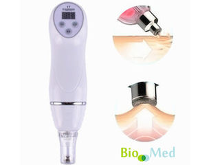 Dermabraziune curatare cu vacuum Diamond Peeling Вакуумная дермабразия foto 2