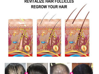 Средство от выпадения и активизация роста волос. Доставка, отправка=бесплатно. foto 6