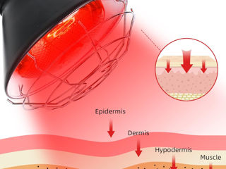 Lampa cu infrarosu terapeutica Терапевтическая инфракрасная лампа foto 5